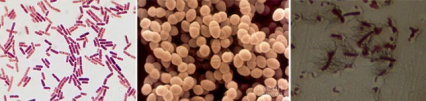 Escherichia Sticks, Fecal Englishoccus եւ Pro - քրոնիկ մանրէային պրոստատների հիմնական պաթոգենները